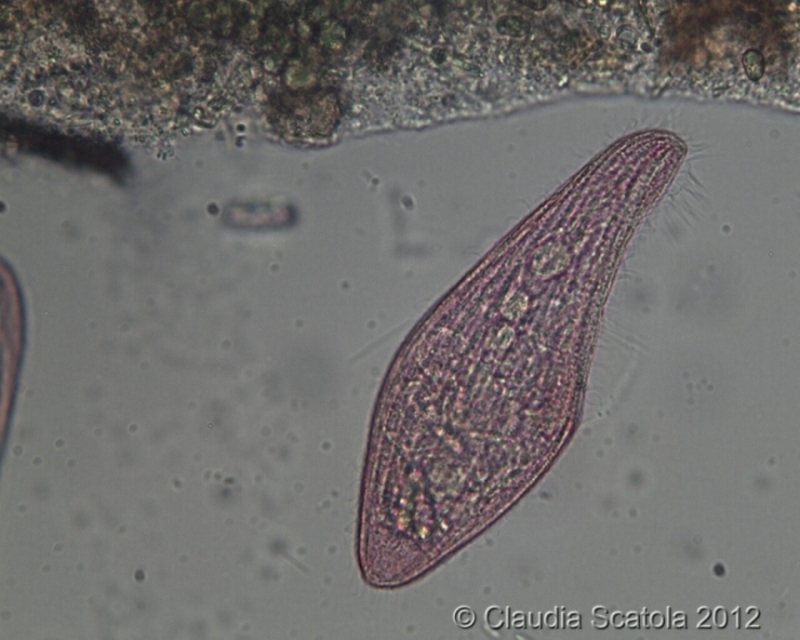 Blepharisma sp.